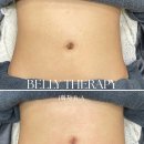 뷰티엠슬림 이미지