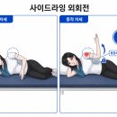 (주)스매싱스포츠 | 방카르트 수술 후 근력 회복과 스포츠 복귀 — 재탈구 없이 돌아가는 기준