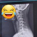 송파문정단단정형외과의원 네이버블로그
