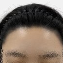 모모헤어라인 이미지
