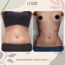 르로제의원 이미지