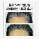 정발산로42번길 | 일산두피문신 출두SMP일산점 헤어라인 3회차 후기