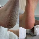 탕정119안전센터 앞 | 천안 아산 문제성발관리 전문 발각질제거 레푸스 탕정점