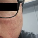 리체안한의원 | 리체안한의원 분당 여드름 치료 솔직 후기