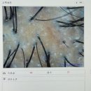 운동화스팀케어 | [광교탈모] 모디슨 광교점 – 1:1 프라이빗 두피관리 받고 효과 바로 느낀 찐 후기