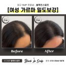 블랙인스칼프 이미지