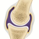 마디케어 이미지