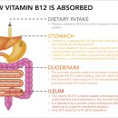 B12 이미지