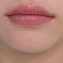 누브의원 이미지