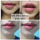 고바우약국 | 창원 중앙동 입술라인 시술 잘하는곳 인투미