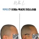 헤어컬 | 서울두피문신 추천｜헤어컬 살린 스타일리시 두피문신, 기타리스트 후기