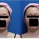 아름턱한의원 이미지