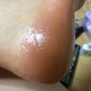 힐링아토