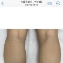 제이아우룸&스킨52