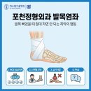 에스엘서울병원 | 포천정형외과 발목염좌, 발목 삐었을 때 절대 하면 안 되는 최악의 행동