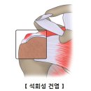 정승기정형외과의원 네이버블로그