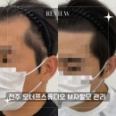 전주 두피관리 오너프스튜디오에서 자연스럽게 헤어라인 완성!