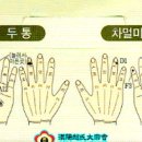 수지침 Daum카페