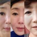 이채윤에스테틱 | 안녕하세요, 양평 에스테틱 스파인바디 원장 이채윤입니다