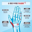 손 통증 부위로 알아보는 질환 5가지 이미지