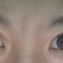 루어즈