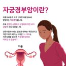 백신으로 예방 가능 한 자궁경부암, 여자와 남자 모두 백신접종필요함 이미지