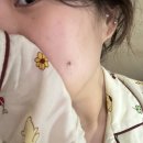 꾸버가(주) | [월간주주] 1월부터 보조개수술한 나 어떠요