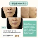 프리스틴의원 | [제품 후기] 셀티아라 인스타그램 #체험단후기 모음