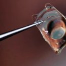 새빛안경콘택트 이미지