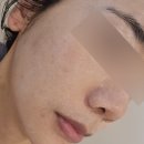 용현시장(관리실) | 인천 용현동 피부관리 사랑에빠진피부 진정수딩관리 후기