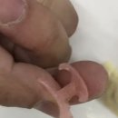 다윗치과기공소 네이버블로그