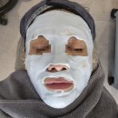 재생한의원 | 하늘체한의원 인천 SONO 재생치료 후기｜새살침·지우개필 이후 여드름흉터 변화 기록