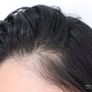 (주)지성글로벌 | 헤드앤숄더 비듬샴푸 추천 가려운 지성두피 관리법