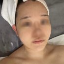 맨손자연성형