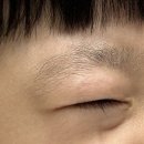 화이트라인하얀피부과