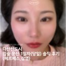다산목욕탕 | 다산신도시 입술 문신 1일차(당일) 내돈내산 솔직 후기 (헤르페스,감염)
