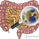과민성 대장증후군 원인은 이미지
