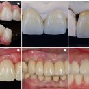 가온치과기공소 이미지