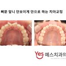 예스안치과의원 이미지