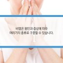 다솜이비인후과 의원 네이버블로그