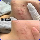 선 피부샵