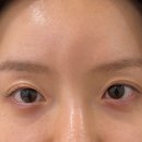 진 스튜디오 | ✨ 자연스럽게 또렷해진 눈매, 스튜디오노을 방문 후기 ✨