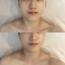 폴에스테틱 | 달서구에스테틱 "폴인뷰티 용산점" - 붓기관리 효과직빵 관리후기