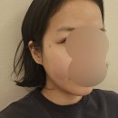 메디서치 | ｜용인 기흥역｜용인피부관리 이목구비순환관리 후기 ｜메디스파 연｜