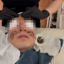필바이오 | 피부가 말랑해지는 기분, ㅣ탄방동피부관리 오드스킨ㅣ 바이오필 관리 리얼후기