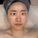 경기도화성시새솔동69-16 | [안산신부관리] 에스테틱 단아에서 리프팅 윤곽관리 받고 온 솔직 후기 (새솔동 피부관리)