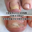 발건강 | 신중동 파고드는 내성발톱, &#34;이젠 안 아파요!&#34; 초등학생 발 건강 되찾은 리얼 후기!