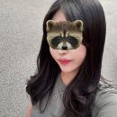 부기2 | [보조개시술 솔직 후기] 시술 당일~2주 (부기, 통증, 몽우리, 주의 사항)