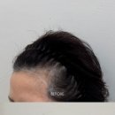 로기SMP 이미지