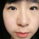에코라인 이미지